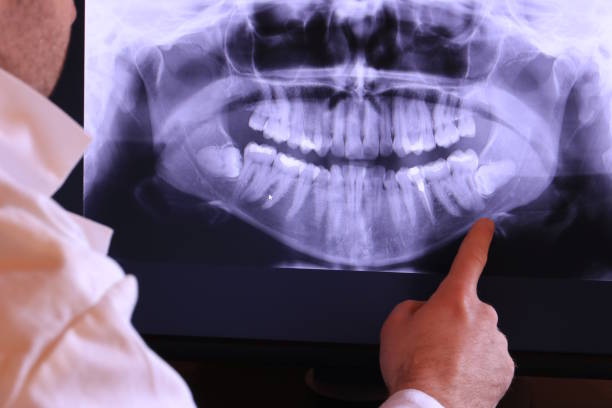 Best Emergency Dentist for Lost Fillings or Crowns in Franklin Park, NJ