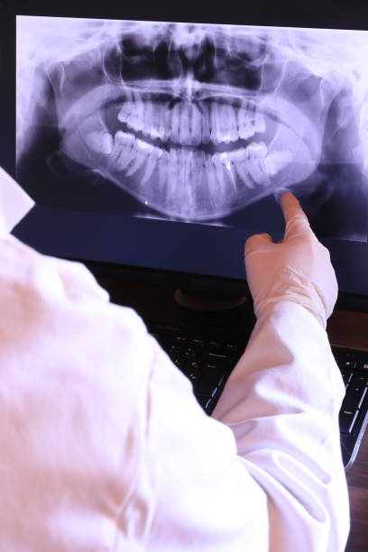 Best Emergency Root Canal Treatment in Franklin Park, NJ